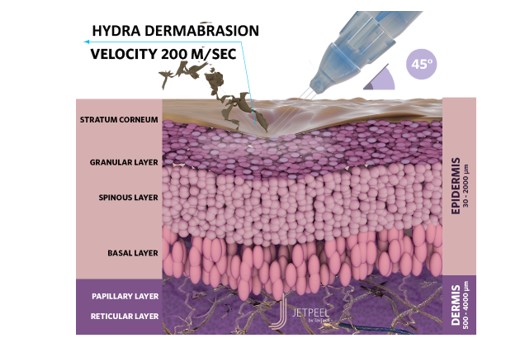 JetPeel Hydradermabrasion
