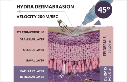 JetPeel Hydradermabrasion