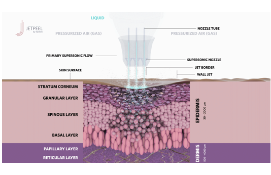 JetPeel Technology