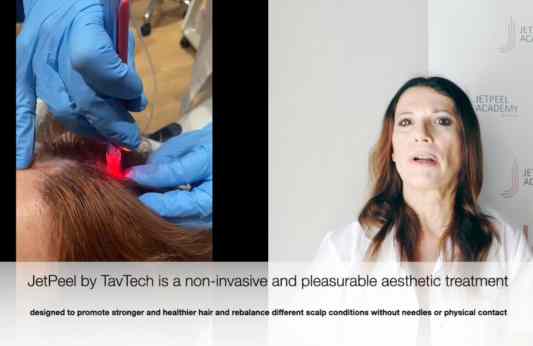 30. Scalp & Hair Treatment with JetPeel by TavTech