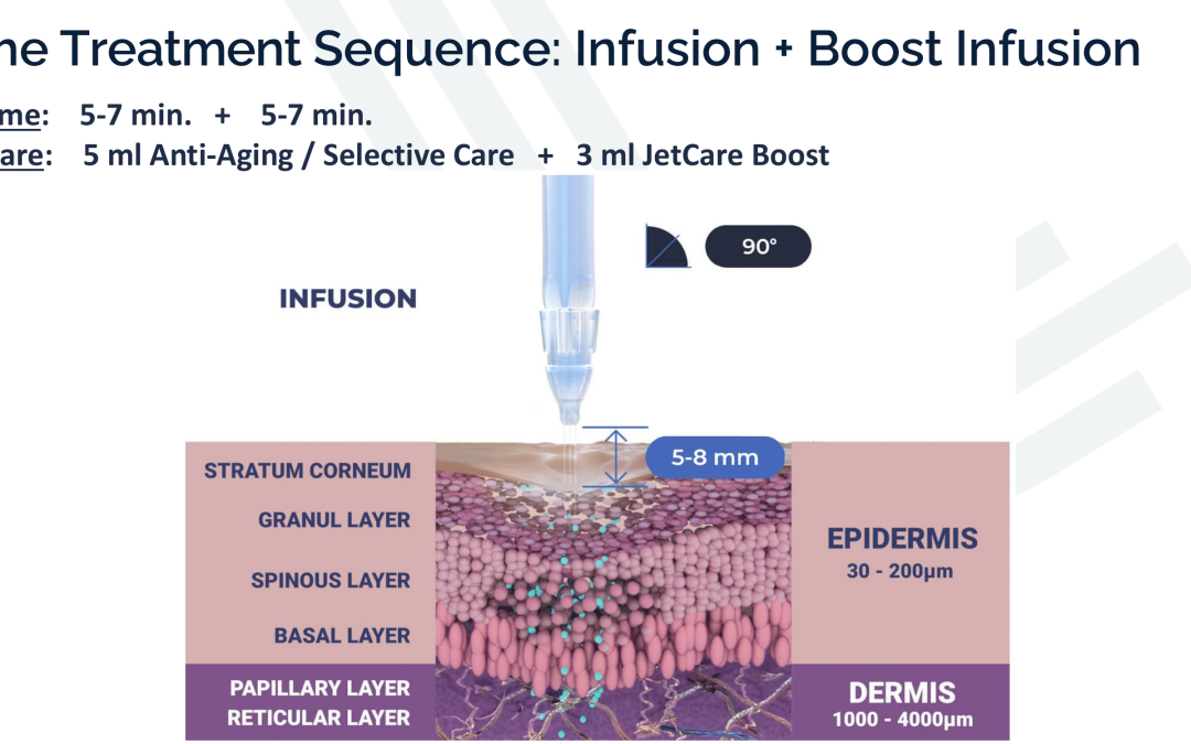 JetPeel Treatment Sequence – Infusion 2