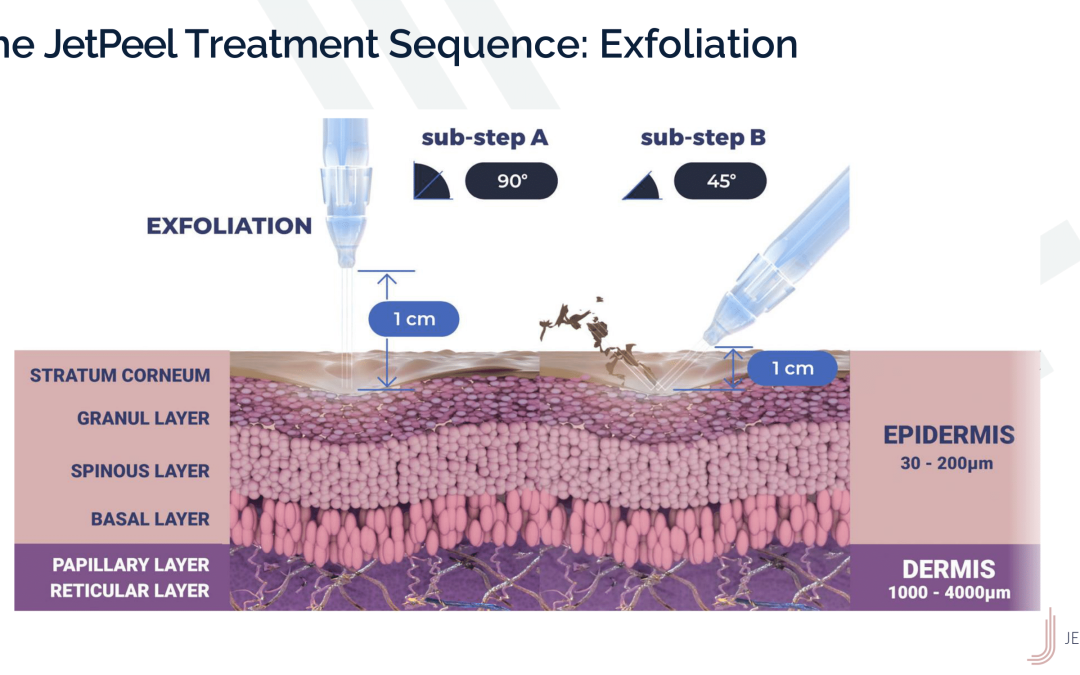 JetPeel Treatment Sequence – Exfoliation 1