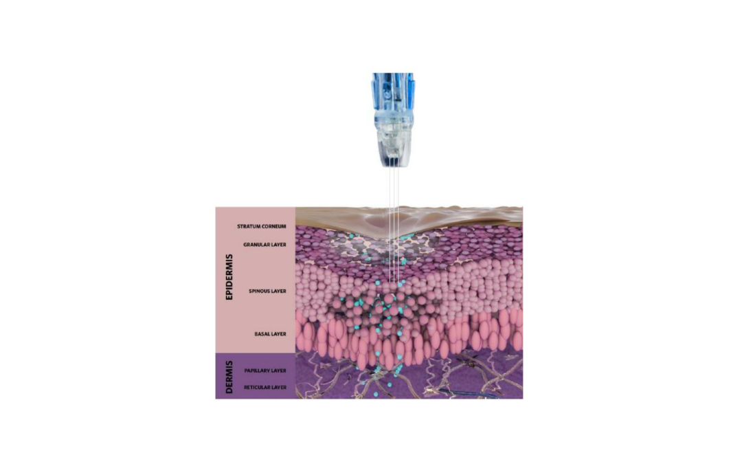 Cavitation and Infusion with non-Sterile Handpiece