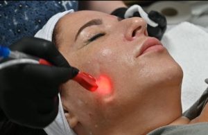 Jet-LED-Red-with-JetPro-Duo-Cheek-and-Chin-5