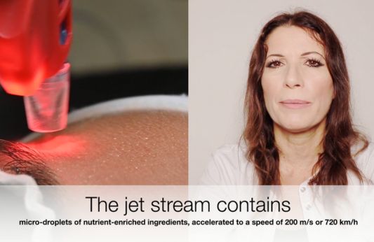 14. What are the benefits of the JetPeel Infusion, what is the technique?