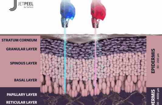 Jet-LED Infusion – Red, Blue LED’s