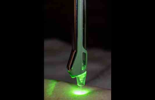 Jet-LED Green simultaneous treatment close-up