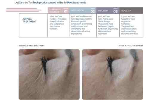 Intensive Hydration and Skin Revitalization – Dr. Wiktoria Odrzywołek