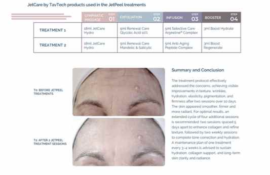 Skin Rejuvenation – Laura Masini