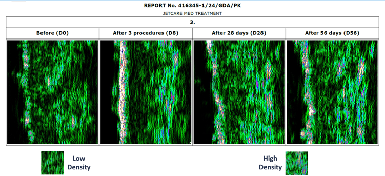 report jetcare med treatment