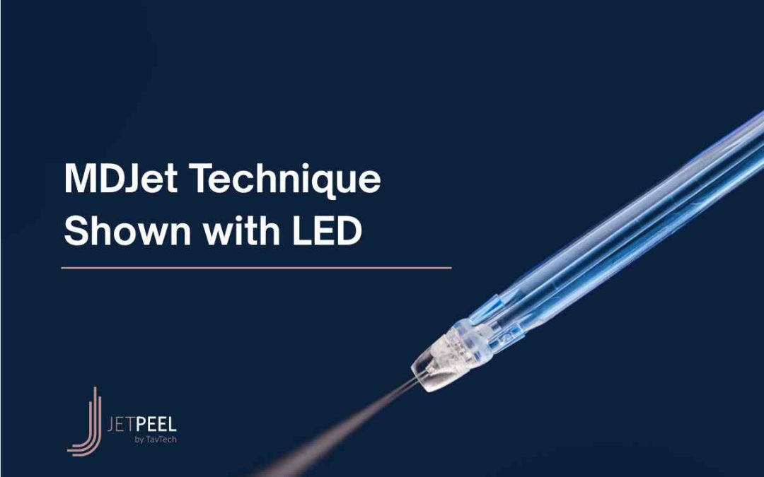 MDJet Technique Shown with LED
