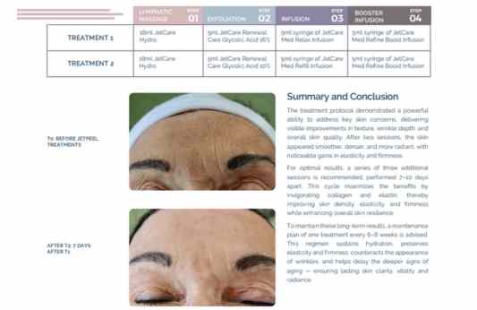 Loss of Tone & Wrinkles – Laura Masini