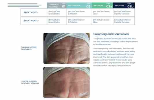 Wrinkle Reduction – Dr. Wiktoria Odrzywołek