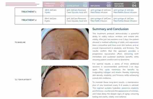 Wrinkles Management – Laura Masini