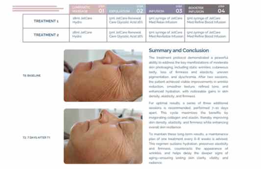 Wrinkles & Laxity – Laura Masini