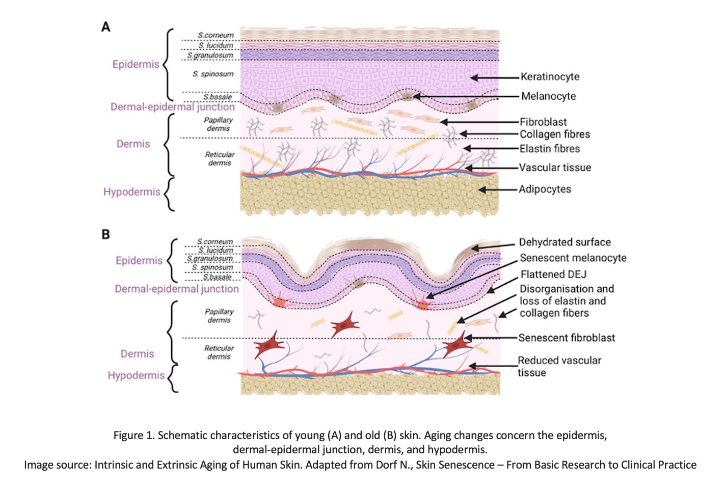 1- schematic characteristion